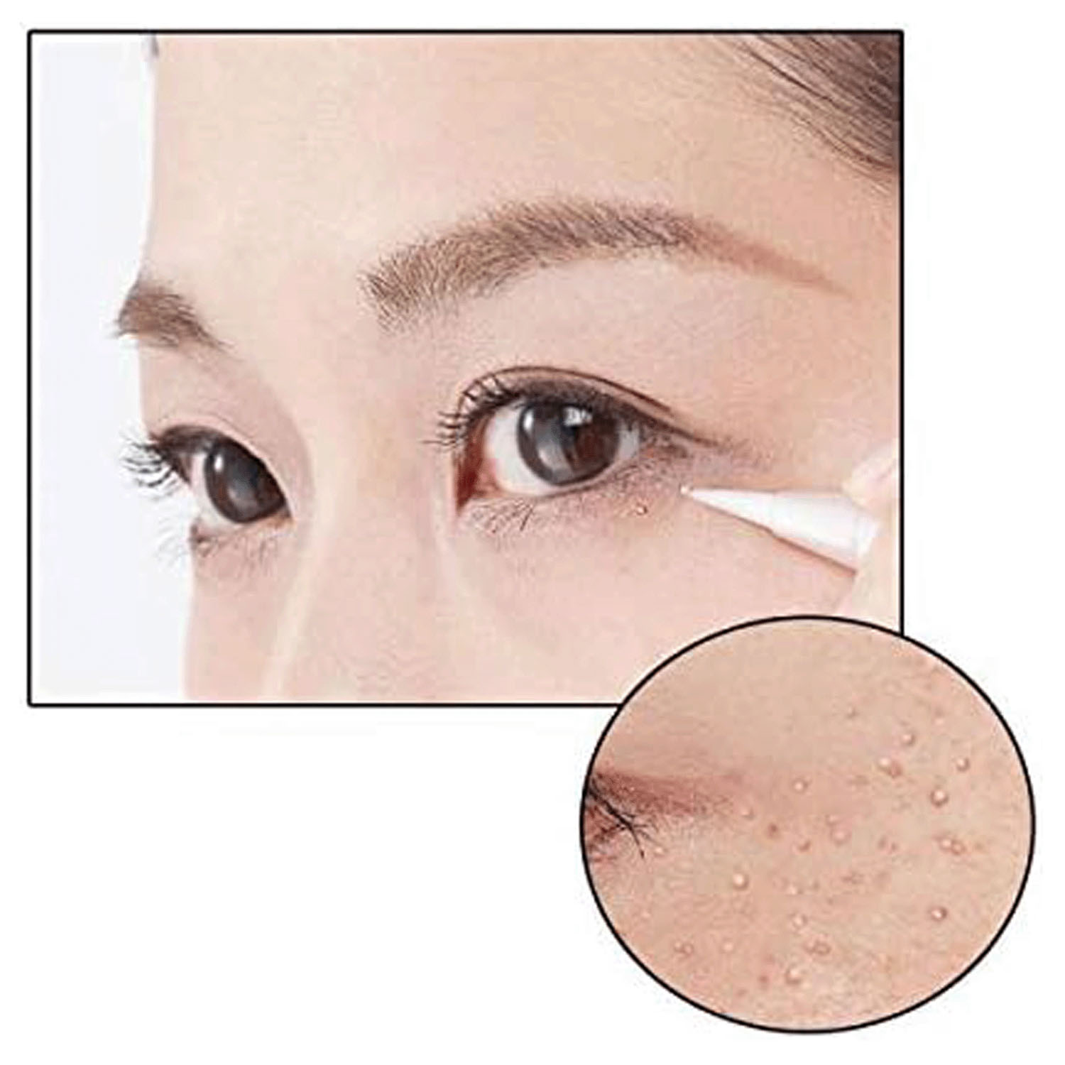 薬用ツブクリン プレミアム - 画像4