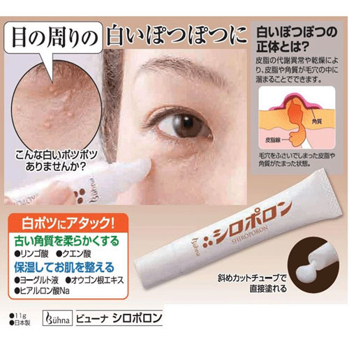 ビューナ シロポロン